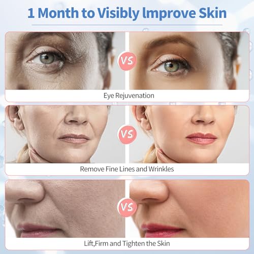 Texet Skin Tightening Device 6-in-1 Microcurrent Facial Device Face Massager, Firming,Lifting, Toning, Wrinkle