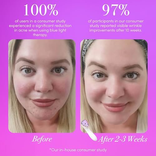 reVive Light Therapy Lux Collection Clinical Acne and Anti-Aging Device