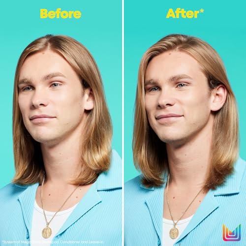 Matrix High Amplify Volumizing Conditioner | Instant Lift & Lasting Volume | Silicone-Free | Boost Structure in Fine, Limp Hair | Salon Professional Conditioner | Packaging May Vary