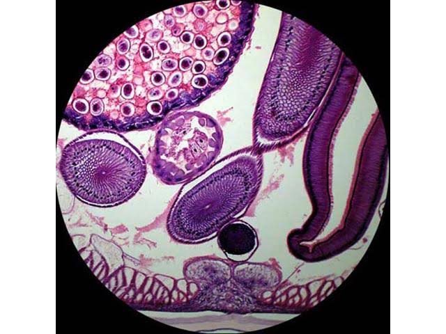 Amscope 40X-640X Metal Body Glass Lens Student Microscope with ABS Case u0026 25