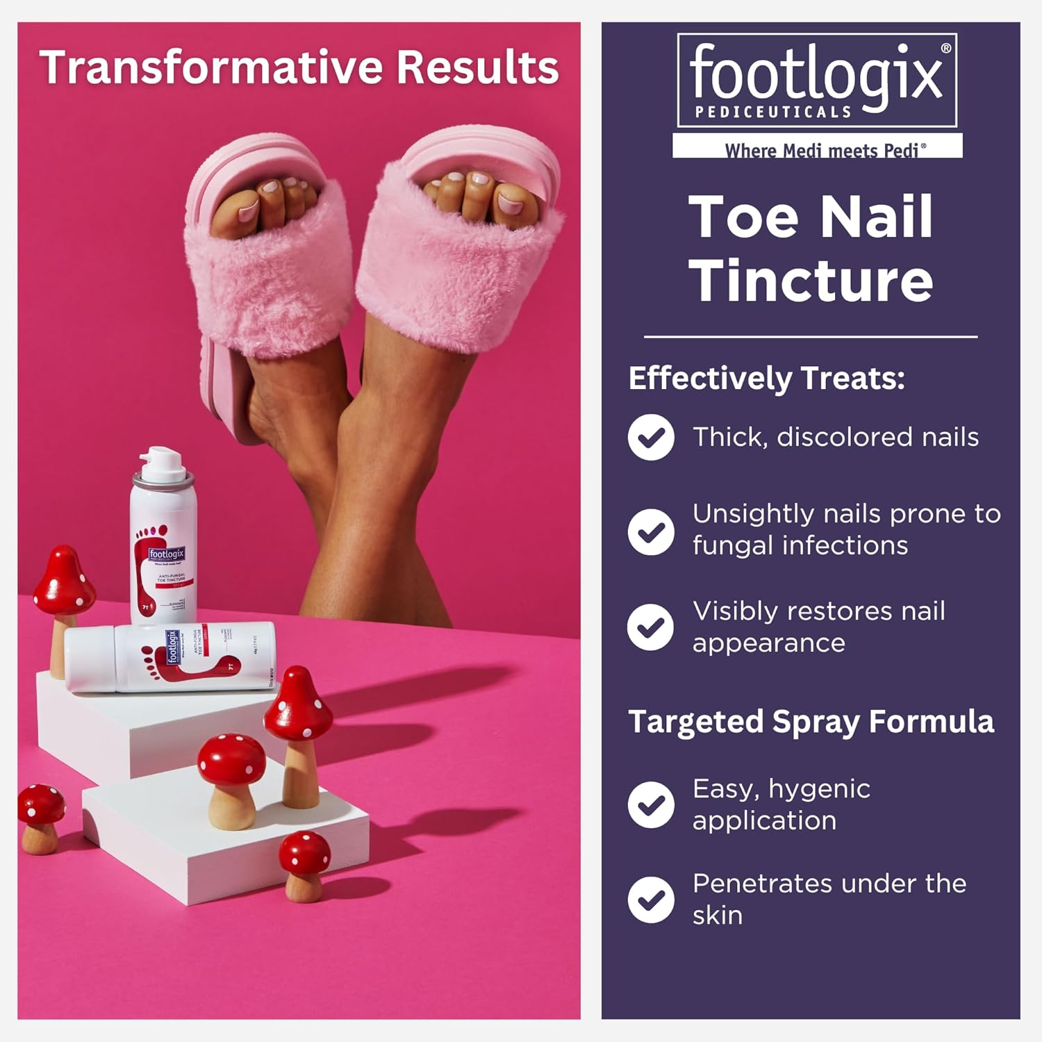 FOOTLOGIX Anti-Fungal Toe Tincture Spray, 1.7 Fl Oz (Pack of 1)