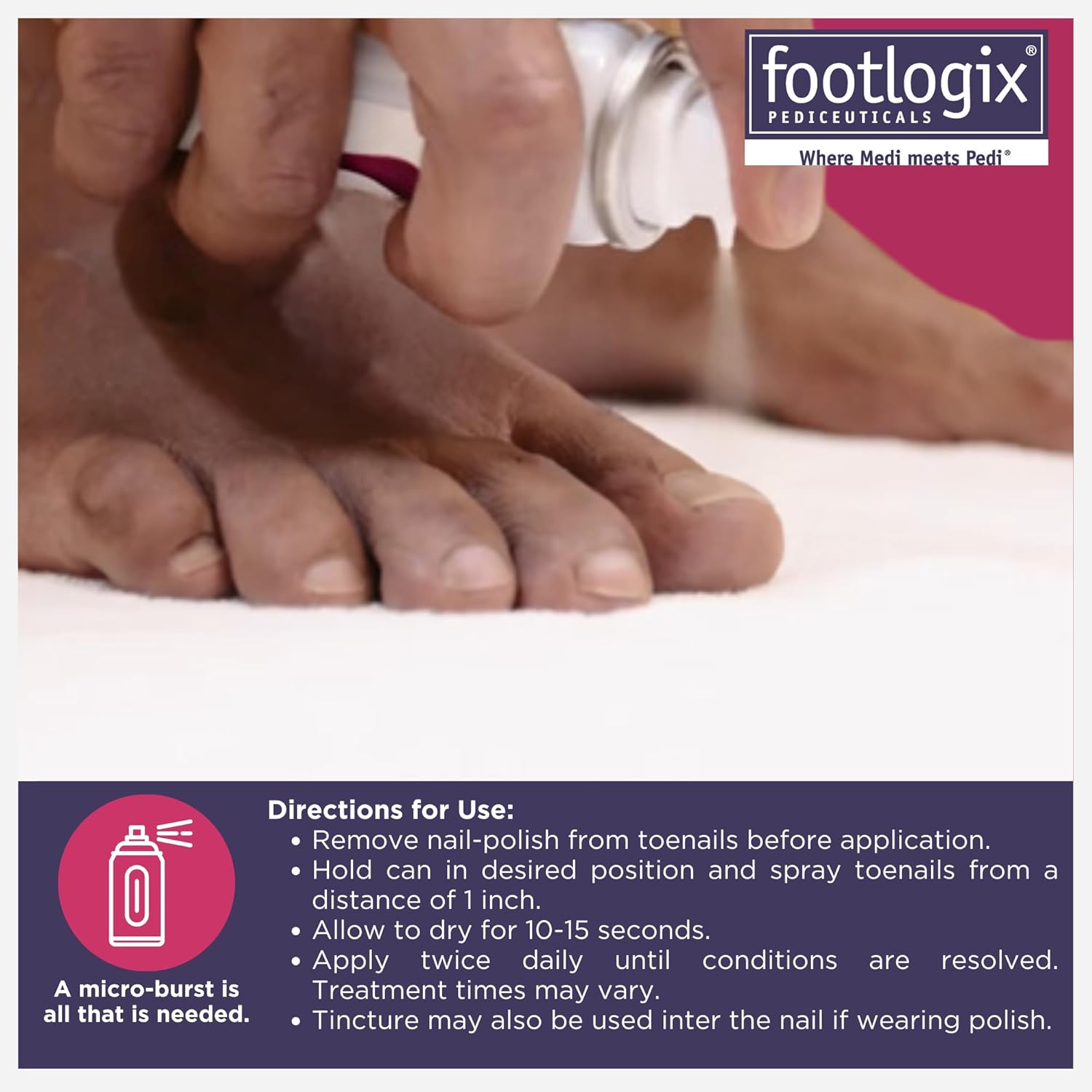 FOOTLOGIX Anti-Fungal Toe Tincture Spray, 1.7 Fl Oz (Pack of 1)