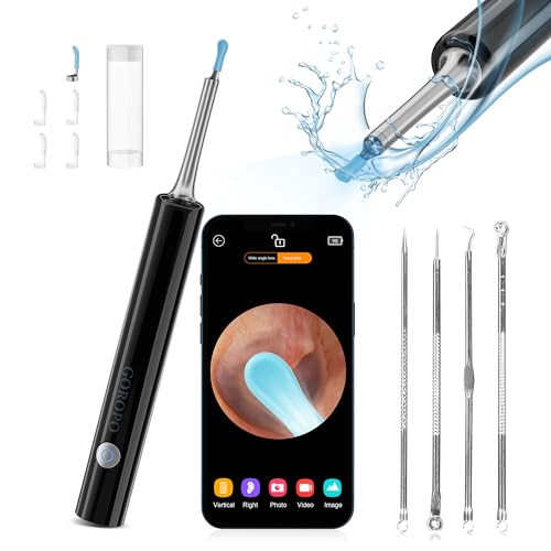Ear Wax Removal, Ear Cleaner with HD Ear Camera, Wireless Ear Otoscope Earwax Remover Kit with 4 Ear Pick & 6 LED Lights, Ear Cleaning Tool for iOS & Android, White