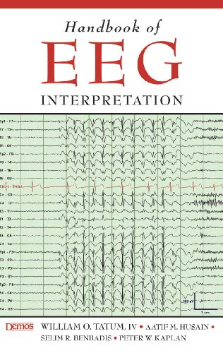 Pre-Owned Handbook of EEG Interpretation Paperback