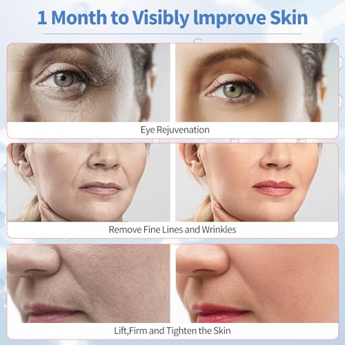 Texet Skin Tightening Device 6-in-1 Microcurrent Facial Device Face Massager, Firming,Lifting, Toning, Wrinkle