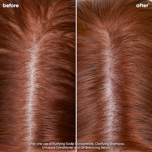 Biolage Scalp Sync Clarifying Shampoo & Universal Conditioner Set | Removes Residue, Buildup & Excess Oil | Paraben & Silicone Free | For Oily Hair & Scalp | Vegan