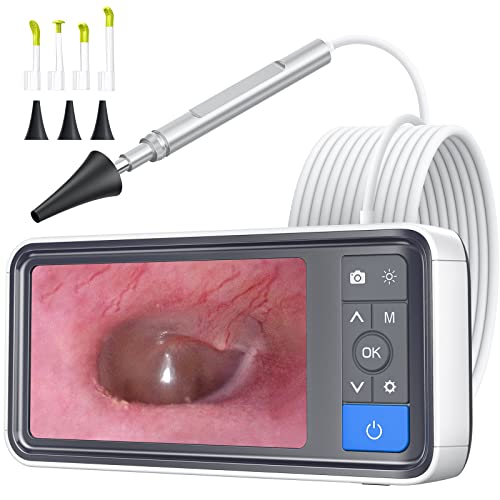 ScopeAround Otoscope Ear Camera with 4.5