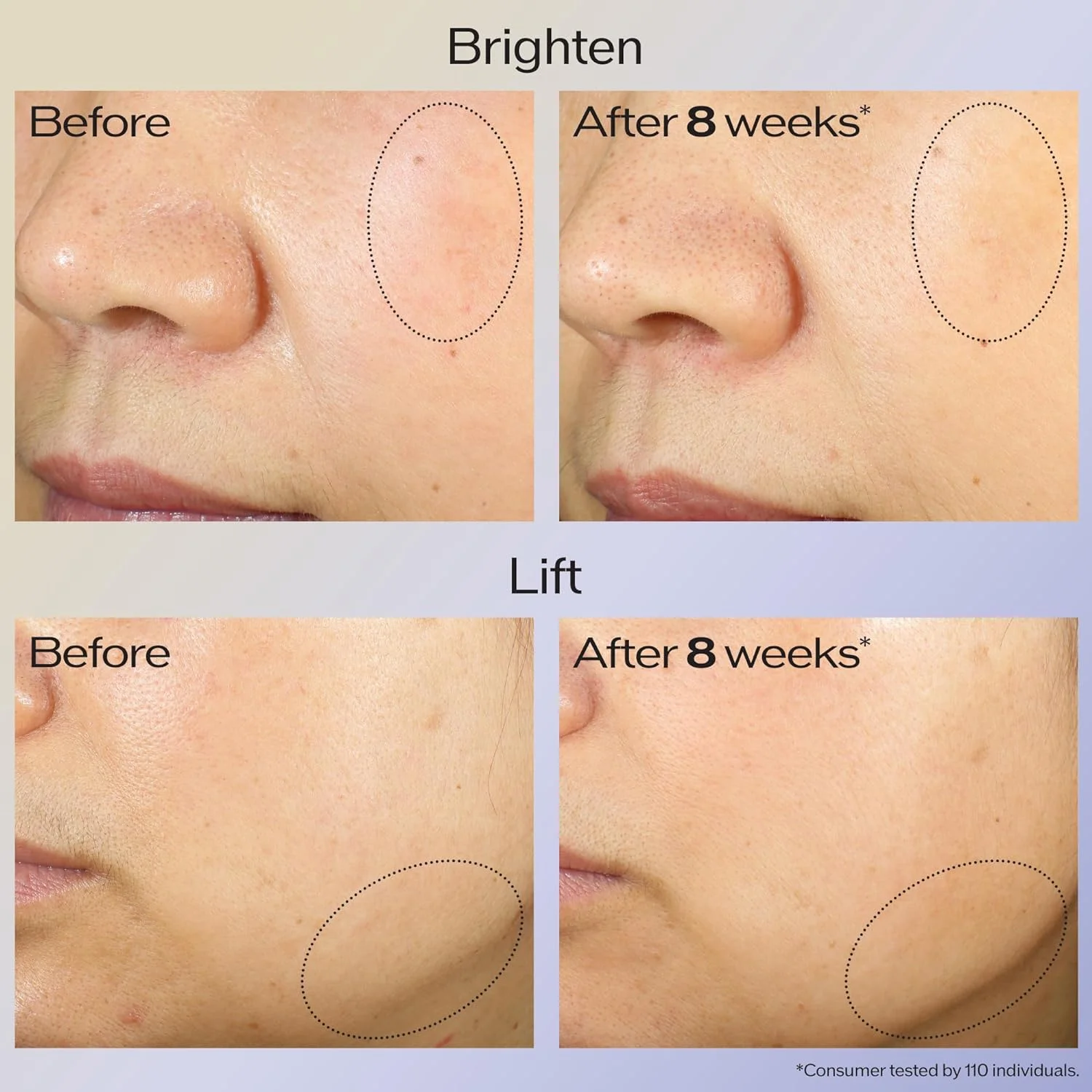 Shisei.do Vital Protection by Shisei.do, 1.7oz /50ml Uplifting and Firming Cream