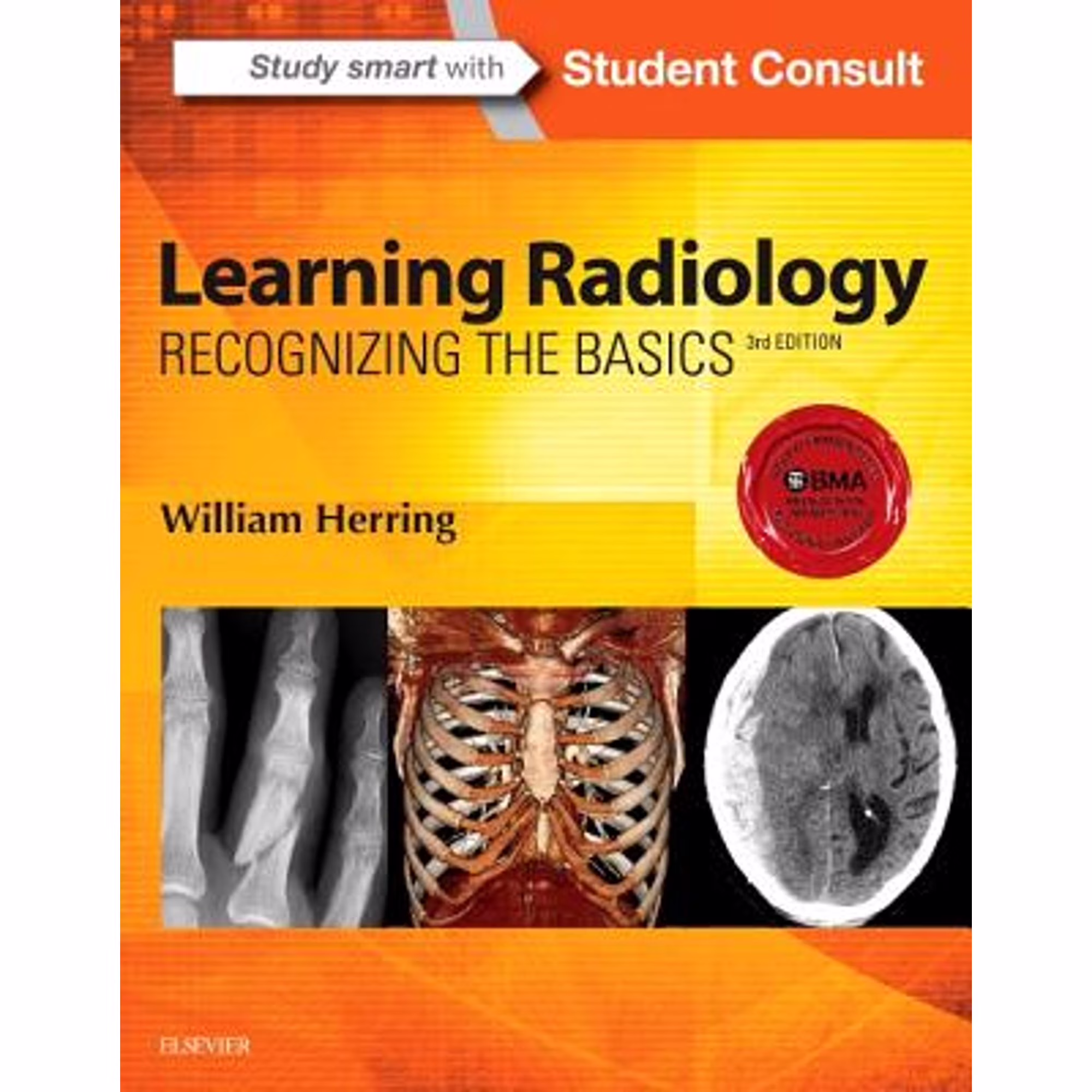 Pre-Owned Learning Radiology: Recognizing the Basics (Paperback 9780323328074) by William Herring