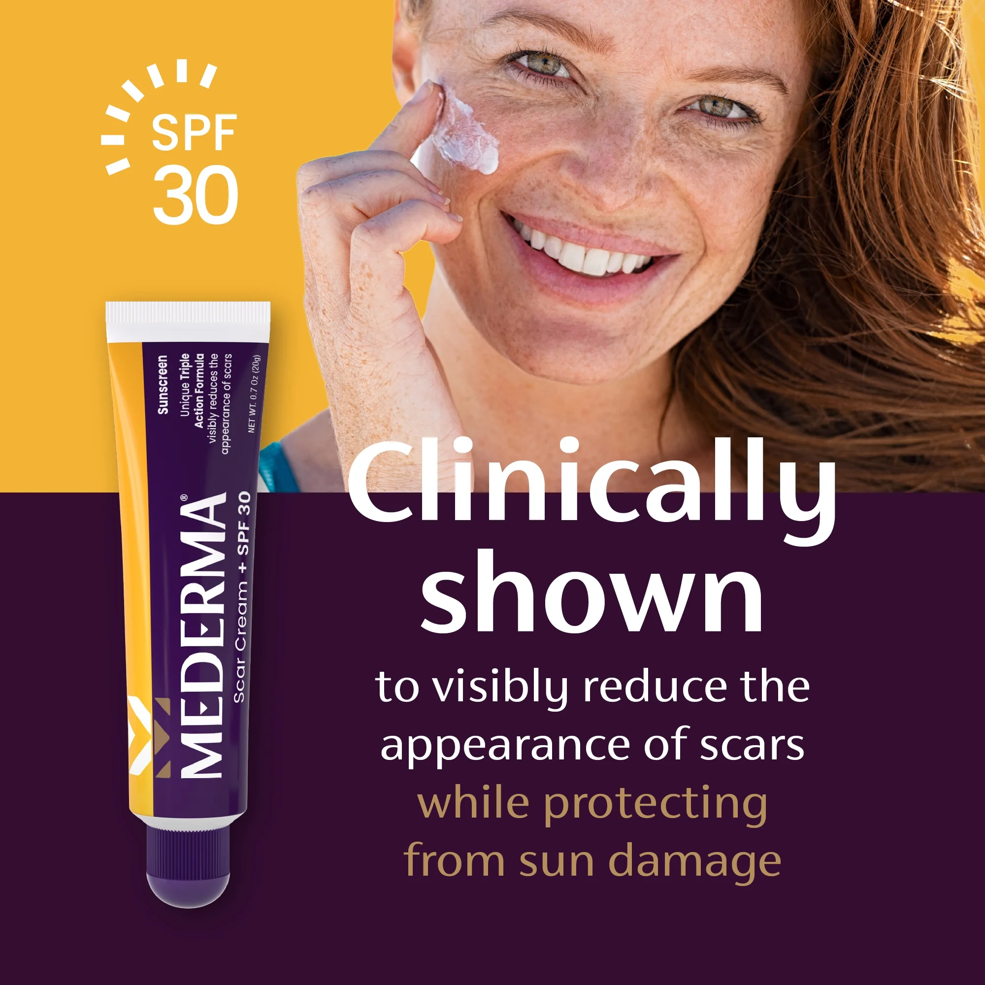 Mederma Scar Cream Plus SPF 30, Sunscreen, Protects Scars from Sun Damage, 0.7 oz (20g)