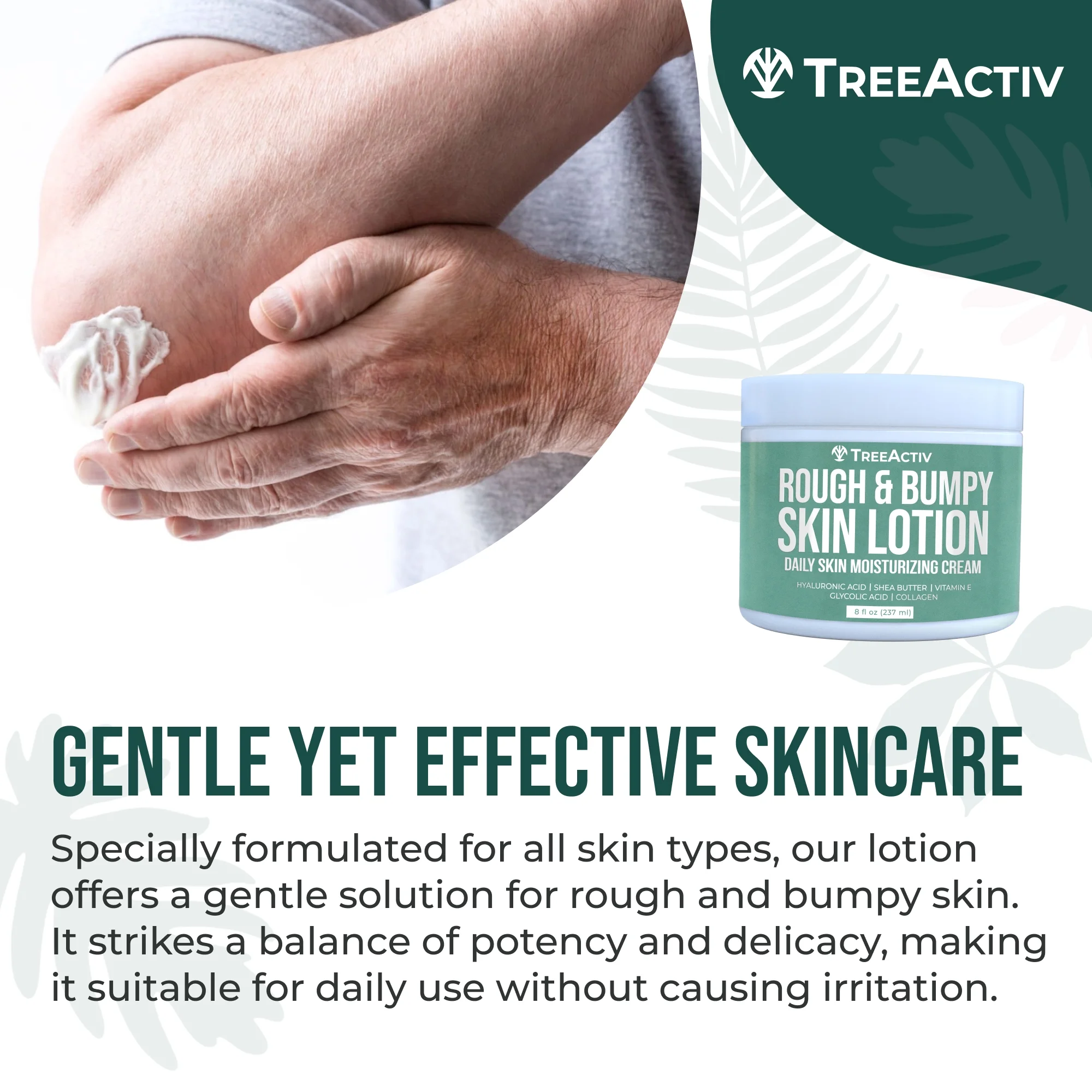 TreeActiv Rough and Bumpy Skin Lotion 8 fl oz, Hyaluronic Acid, Shea Butter & Vitamin E