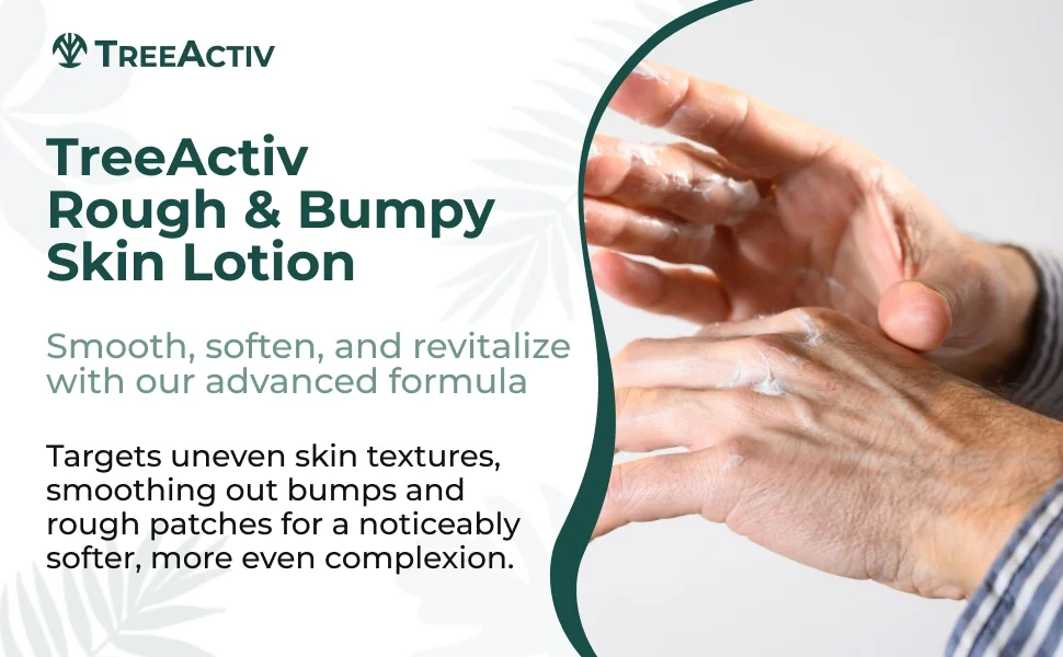TreeActiv Rough and Bumpy Skin Lotion 8 fl oz, Hyaluronic Acid, Shea Butter & Vitamin E