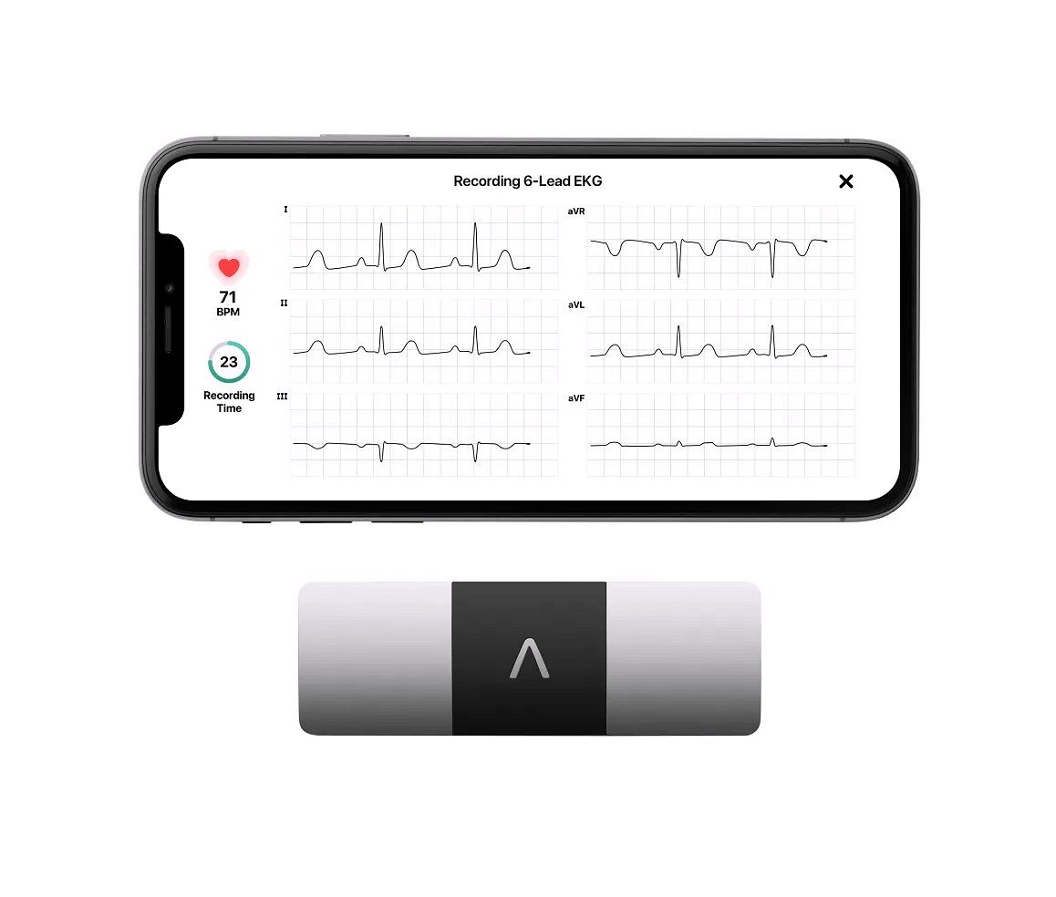 KardiaMobile 6L Moniteur ECG personnel pour smartphones